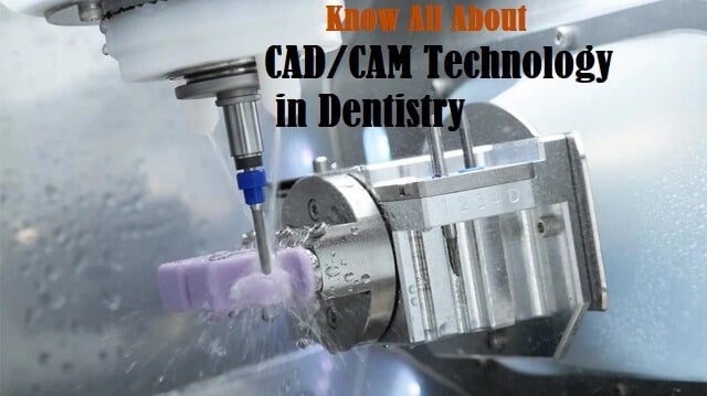 Cad cam 1 (1)