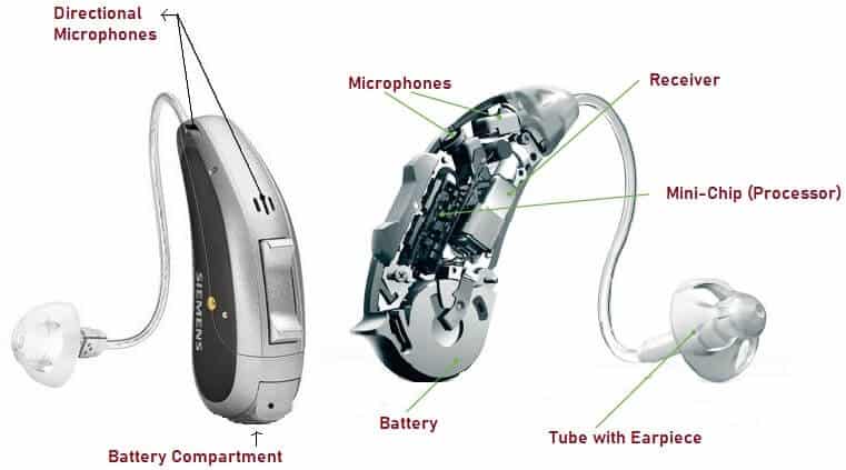 Digital Hearing Aid - How It Works, Types, Components, Advantages