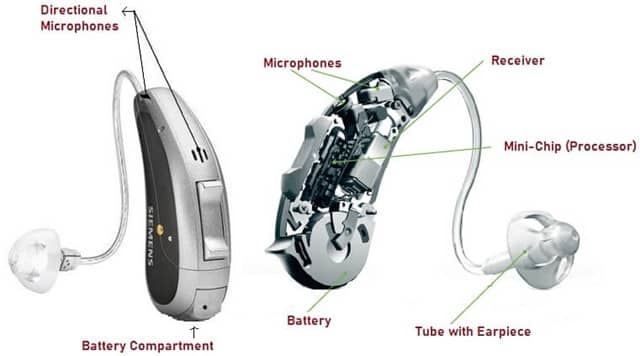 Digital Hearing Aid - How it Works, Types, Components, Advantages