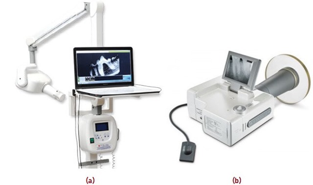 Digital Radiography In Dentistry - How It Works, Types, Applications