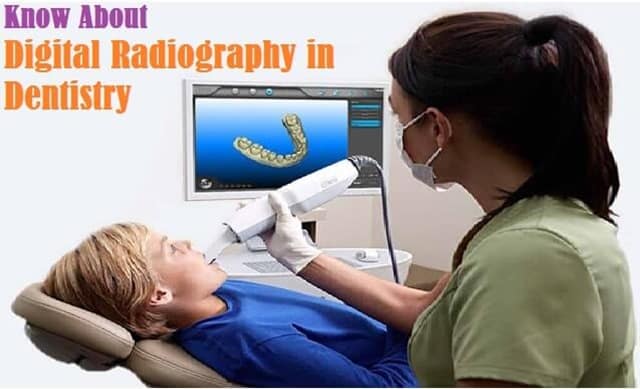Introduction to Digital Radiography in Dentistry