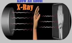 Introduction to X-Ray