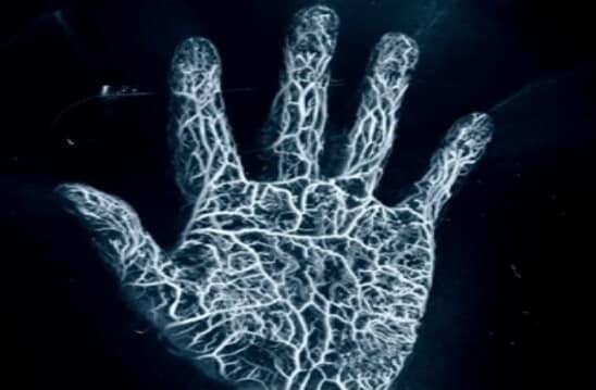 Photoacoustic image of hand